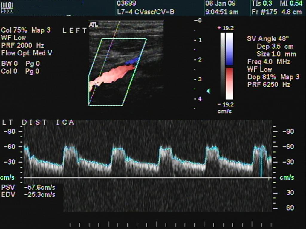 LICA spectrum