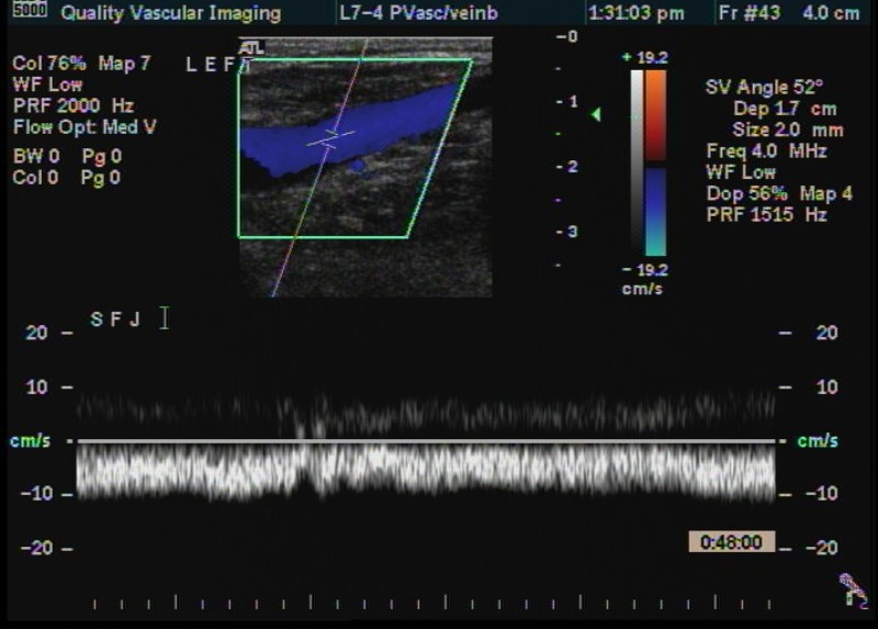 cfv spectrum