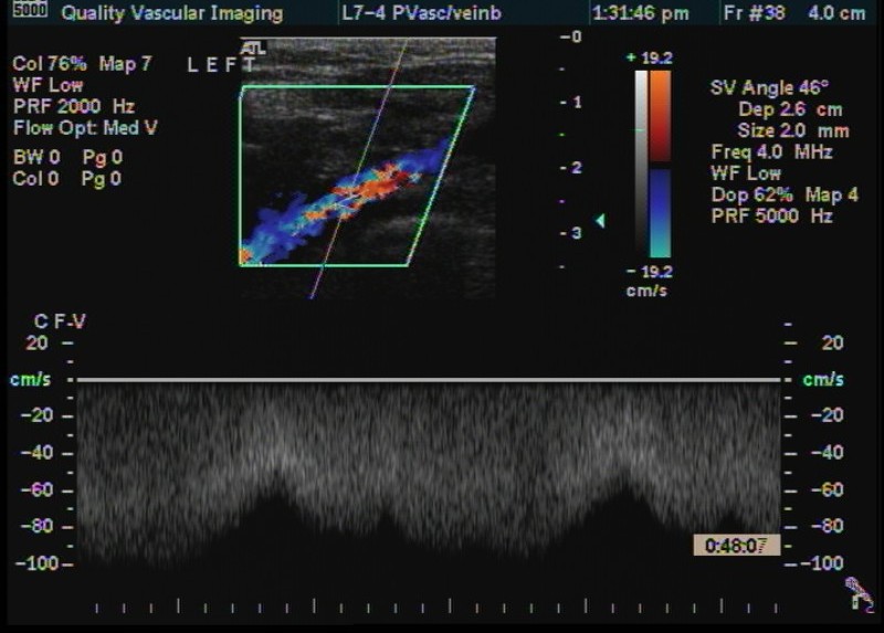 cfv spectrum