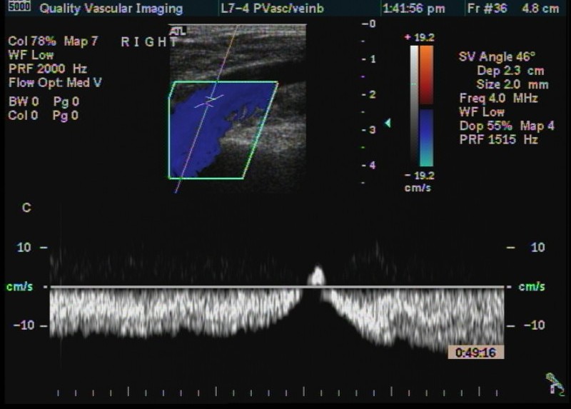 rt cfv spectrum