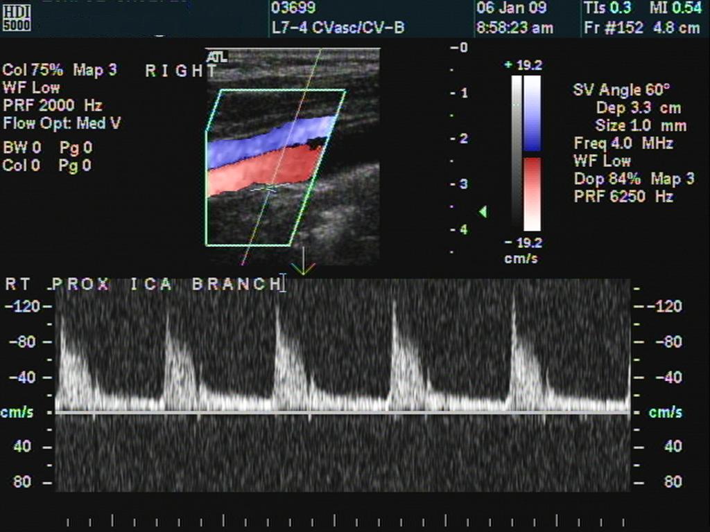 spectrum RICA branch