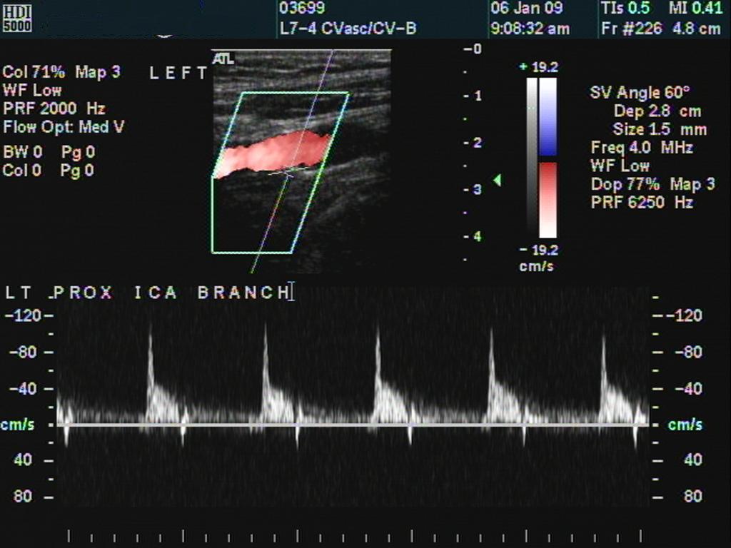 spectrum LICA br