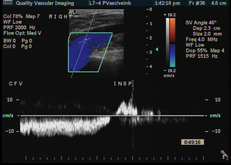 cfv spectrum2