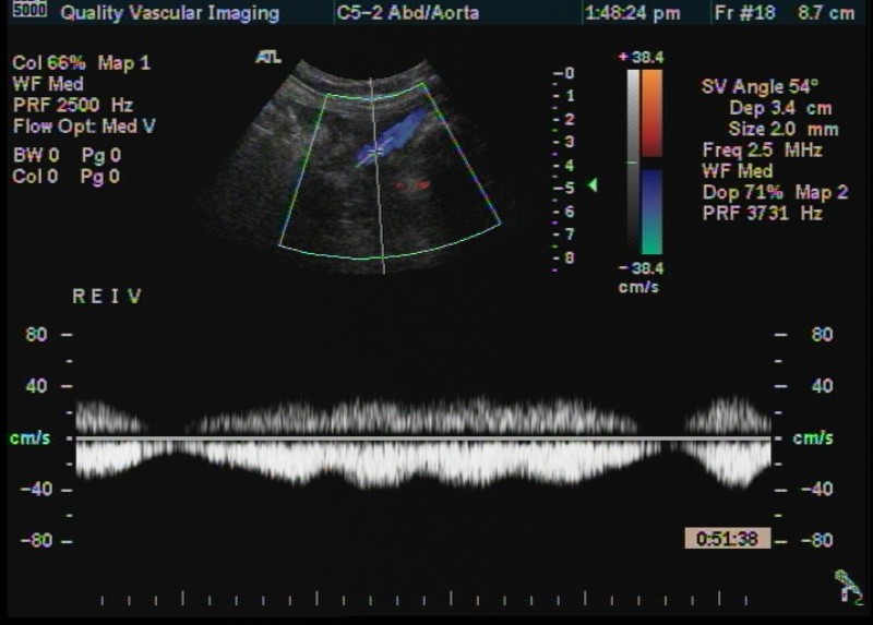 reiv spectrum